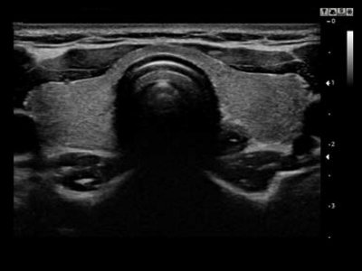 Echogramm was received by ultrasound system RuScan 60
