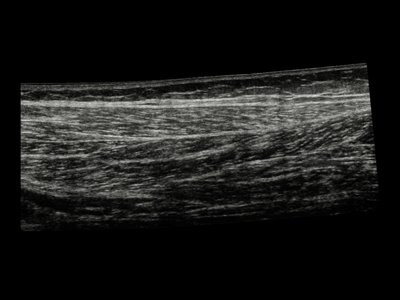 Echogramm was received by ultrasound system RuScan 60