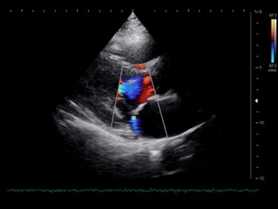 Echogramm was received by ultrasound system RuScan 60