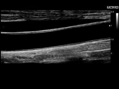 Echogramm was received by ultrasound system RuScan 60