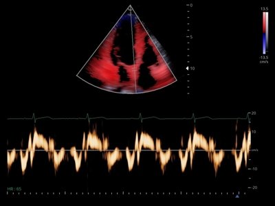 Echogramm was received by ultrasound system RuScan 60