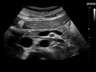 Echogramm was received by ultrasound system RuScan 60