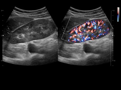 Echogramm was received by ultrasound system RuScan 60