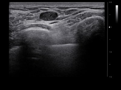 Echogramm was received by ultrasound system RuScan 60
