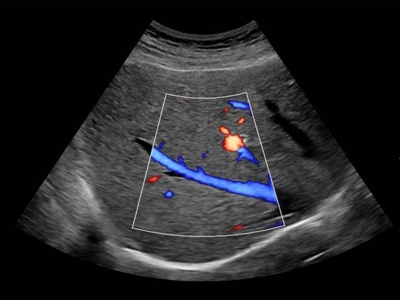 Liver, S-Flow™ / RuScan 65