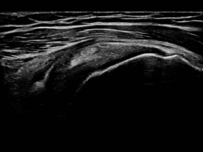 Shoulder joint / RuScan 65