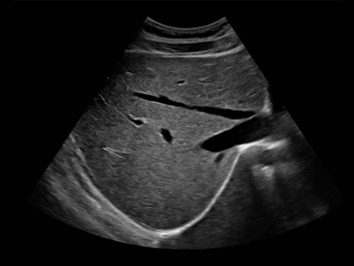 Liver / RuScan 65