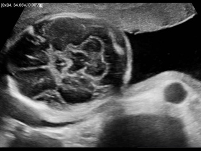 Fetal brain / RuScan 65
