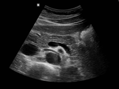 Pancreas / RuScan 65M