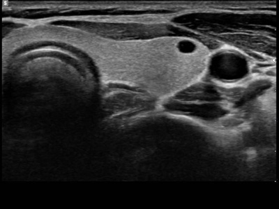 Thyroid / RuScan 65M