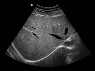 Liver / RuScan 65M